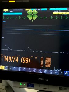 monitor cardio